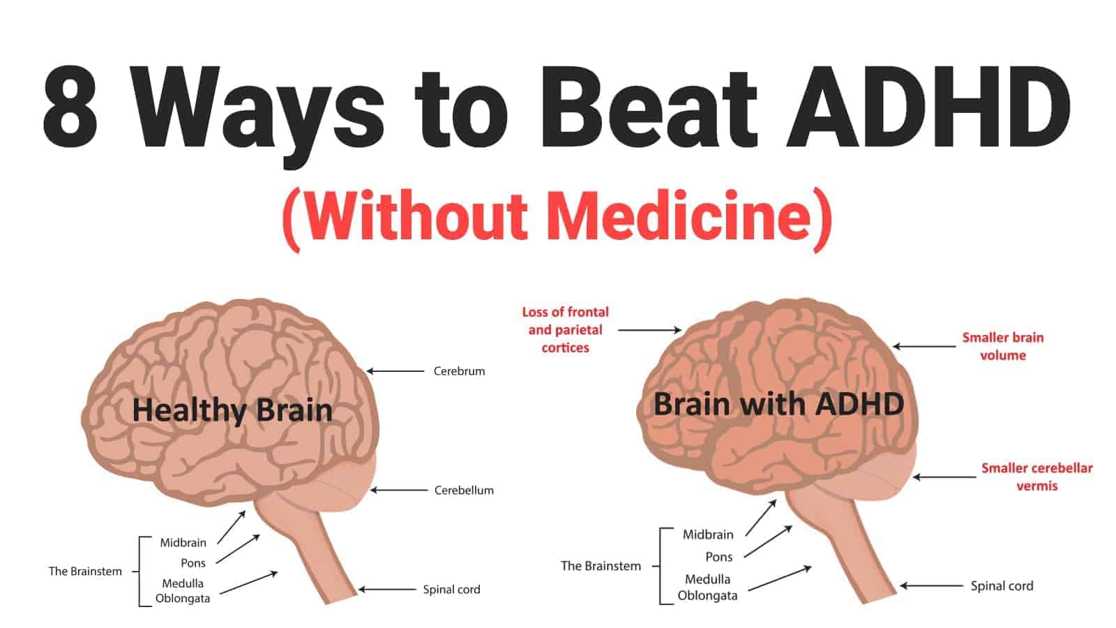 How To Treat Adhd Without Medication