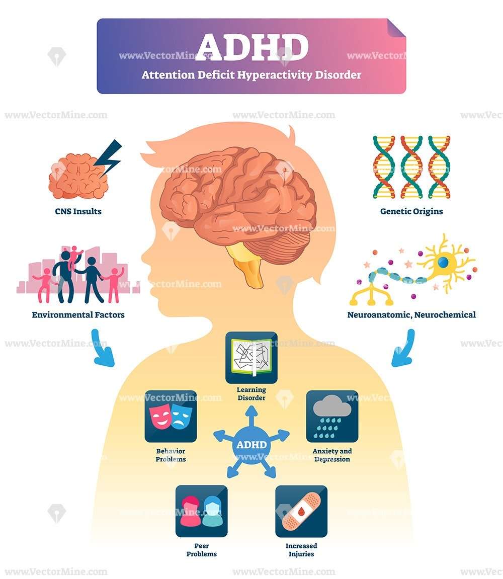 ADHD disorder medical vector illustration infographic