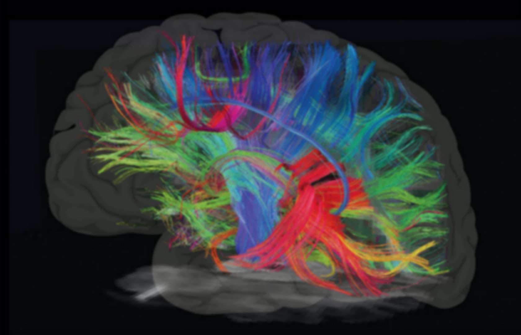 Autism brain imaging PS1030