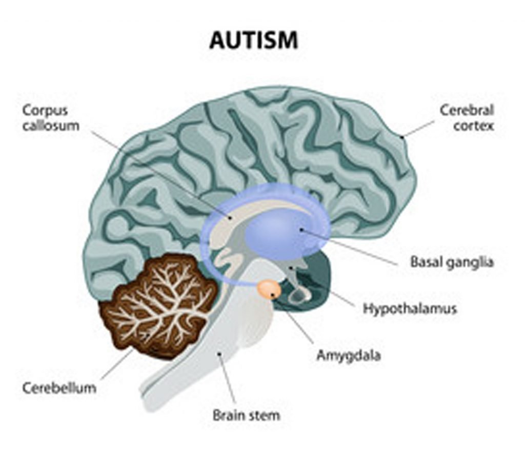 how-does-autism-occur-in-the-brain-autismtalkclub