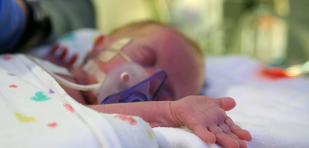 Brain differences in premature babies who later develop autism