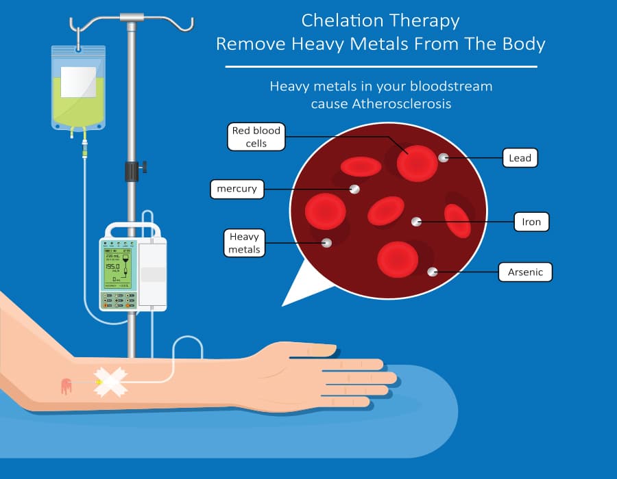 Chelation Therapy: A Brief History