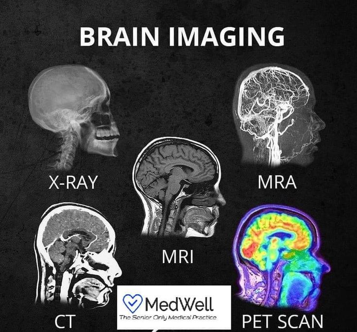 Head brain scan types