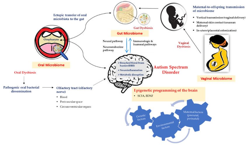 Illustration of autism spectrum disorder (ASD) and its ...