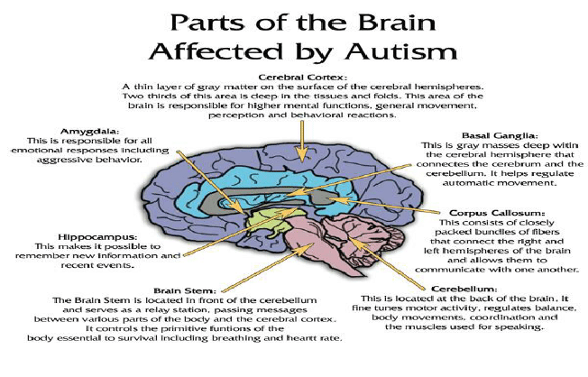Parts of the Brain Affected by Autism