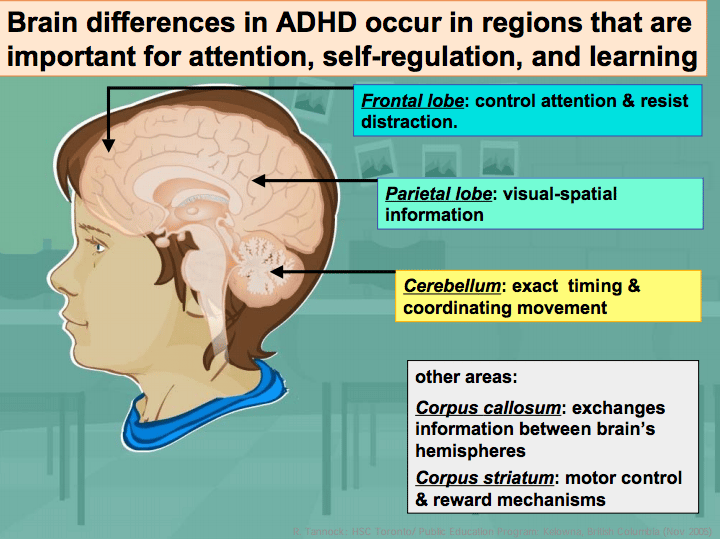 Pin op ADHD, SPD, Dyslexia, Autism...